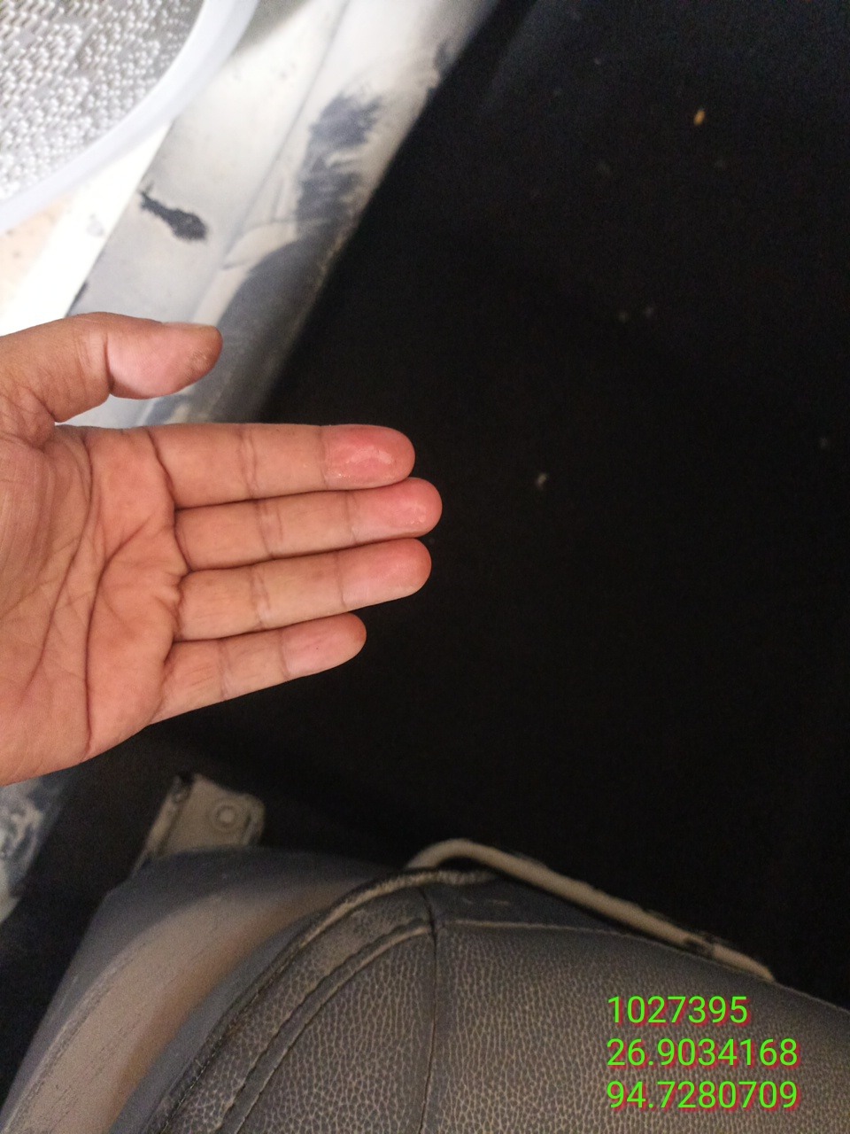 thumb